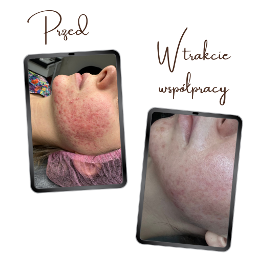 Katarzyna Krzywańska