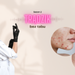 Trądzik hormonalny jak go rozpoznać i jak się go pozbyć?