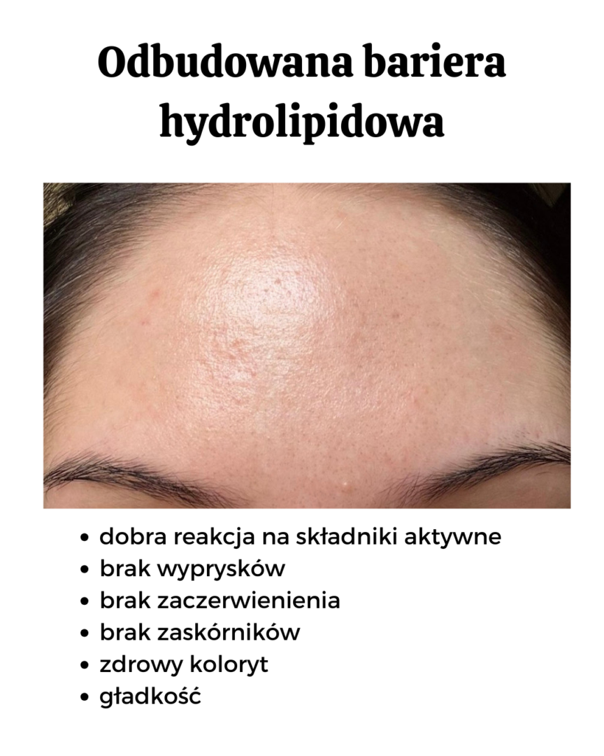 odbudowana bariera hydrolipidowa, przed i po,