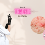 8 pytań, które musisz sobie zadać jeśli masz trądzik!